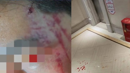 17岁男生遭校友殴打，逼他下跪喊爸爸，对方被拘后参加高考