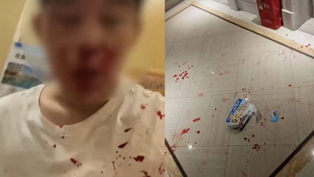 17岁男生遭殴打报警后被二次施暴，两家人是世交